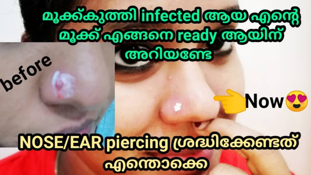 How To Treat Infected Nose/Ear after piercing/how to care after piercing/malayalam