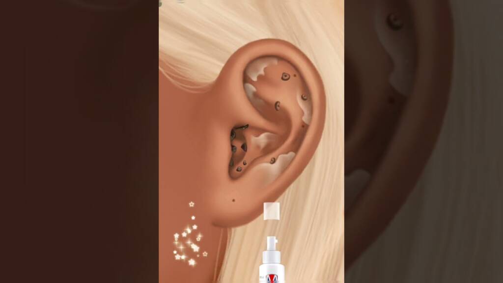 Ohr 👂 Knacken/Ohrlochstechen 👂/Ohrenreiniger 👂/Ohren wachsen und reinigen 🫧/Hautpflegeroutine Pickel entfernen 👂